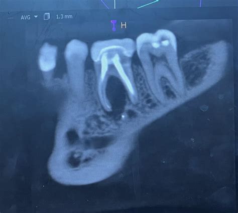 r/askdentists|1633 best r/askdentists images on Pholder .